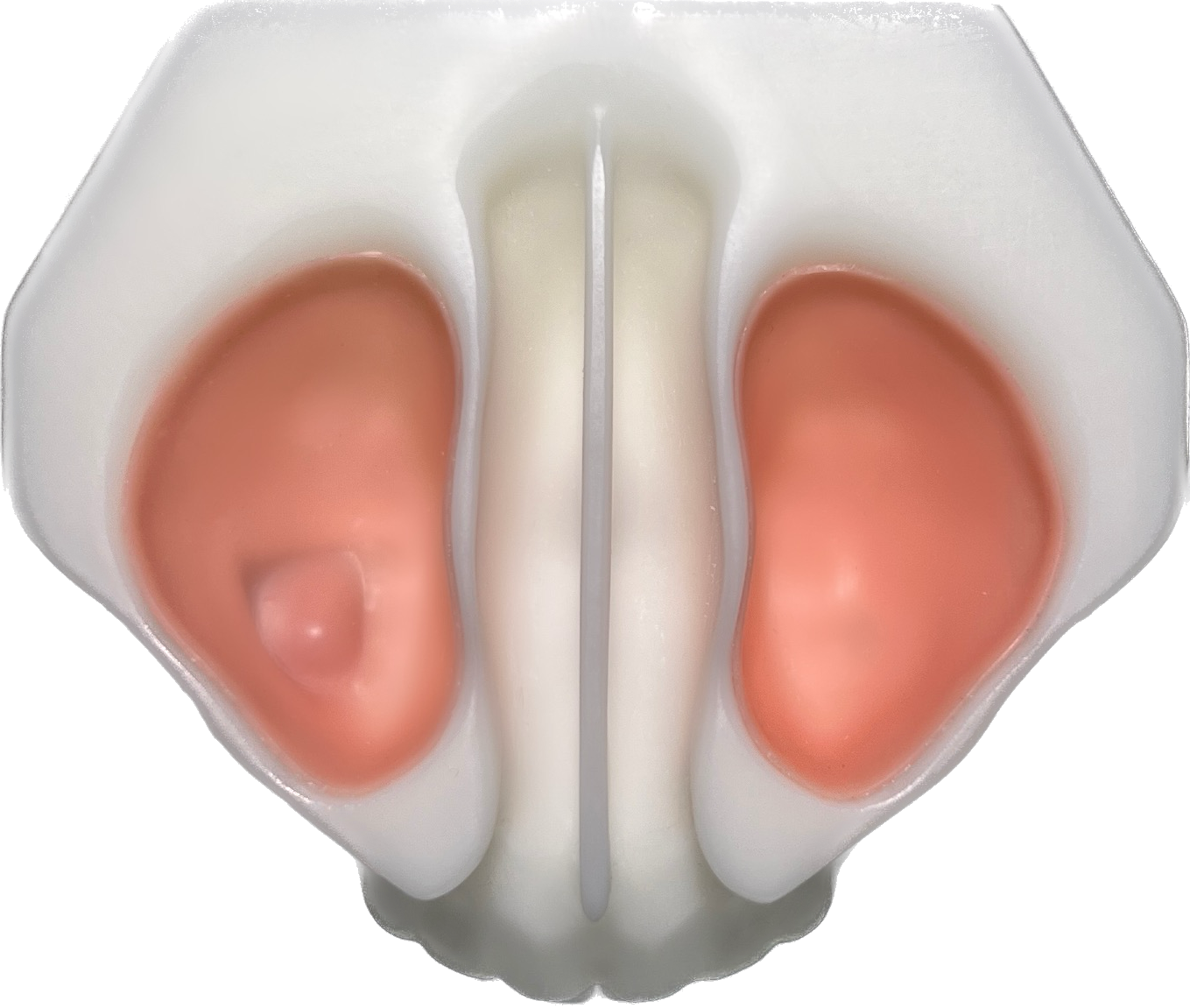 Direct and Indirect Sinus Lift Model